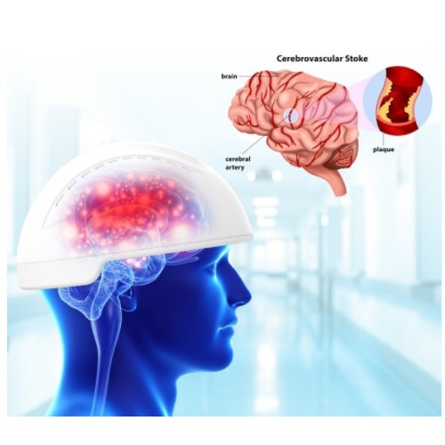 Therapiegerät zur Behandlung von Hirnerkrankungen mit Infrarotlicht