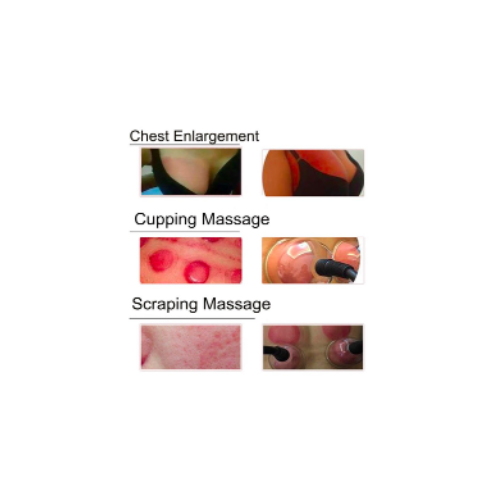 Vakuumtherapiegerät zur Brust- und Gesäßvergrößerung, 6 Saugnäpfe