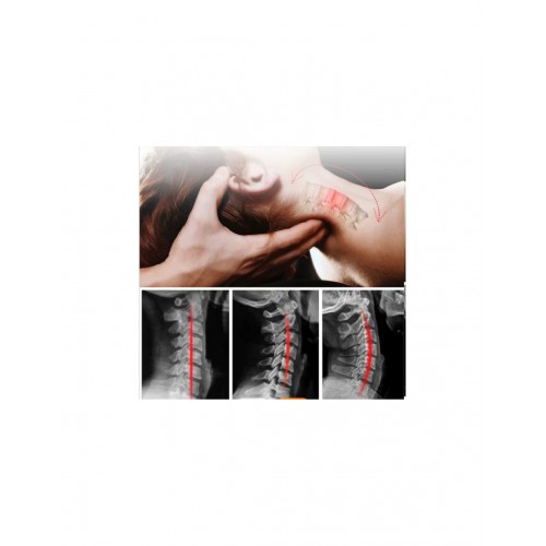 Alphay 4 in 1 Medizinisches Gerät für den zervikalen Bereich - Massage, Bewegungstherapie, Schwarz